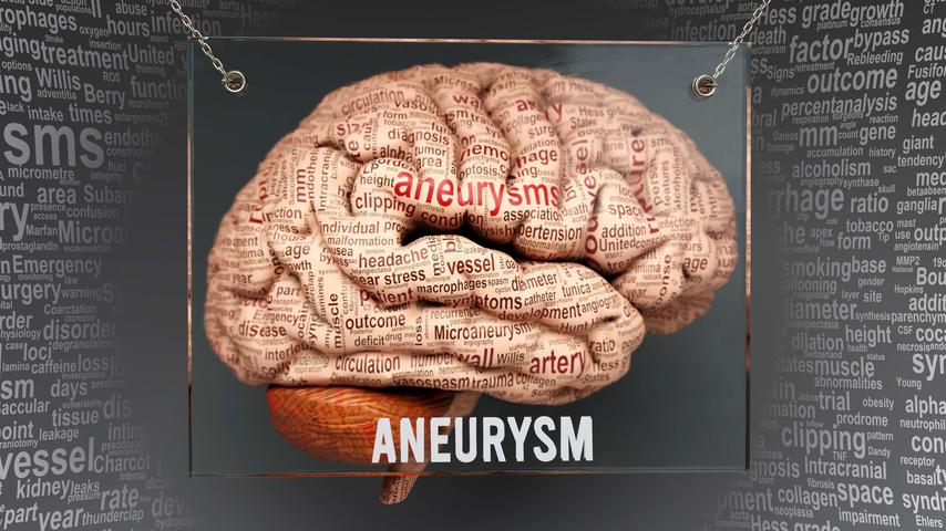 Brain-Aneurysm-scaled