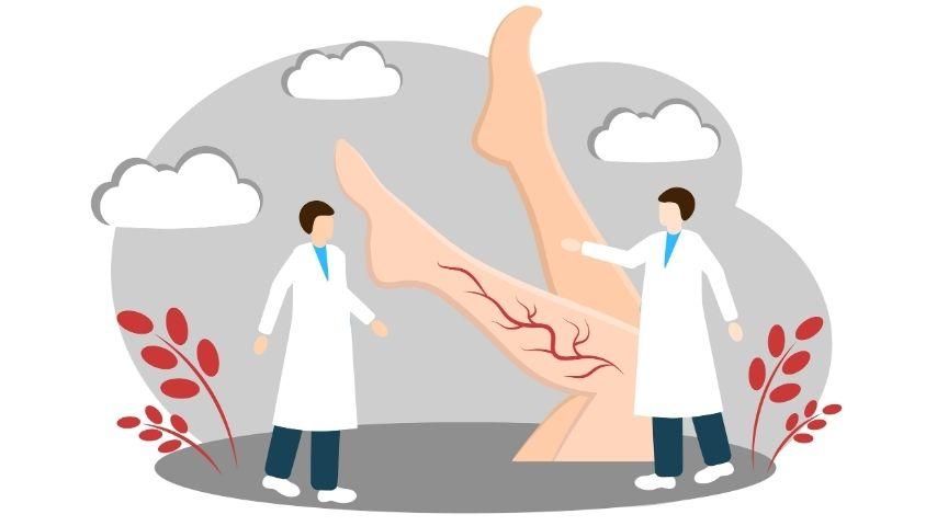 What to Expect During Endovenous Ablation or Sclerotherapy &mdash; Step-by-Step Patient Experience