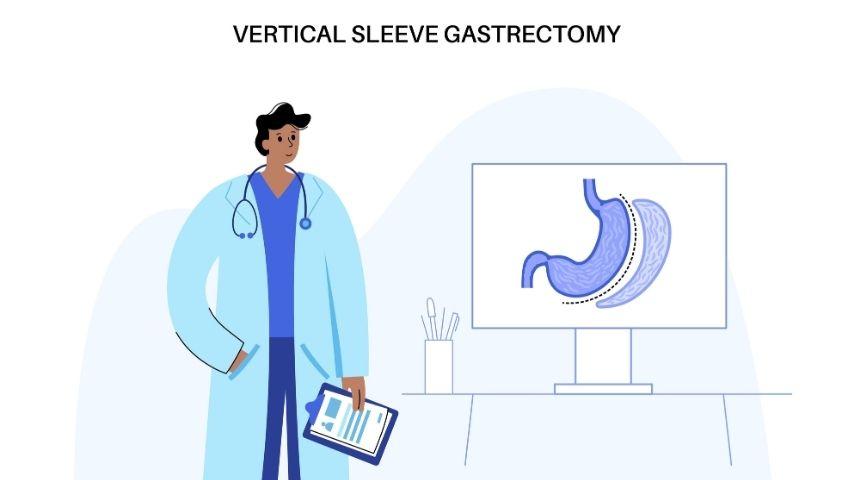 What Questions Should I Ask My Surgeon Before Signing Up for Bariatric Surgery