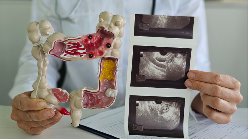 Gastrointestinal Interventional Radiology-The Hidden Procedures Changing GI Care