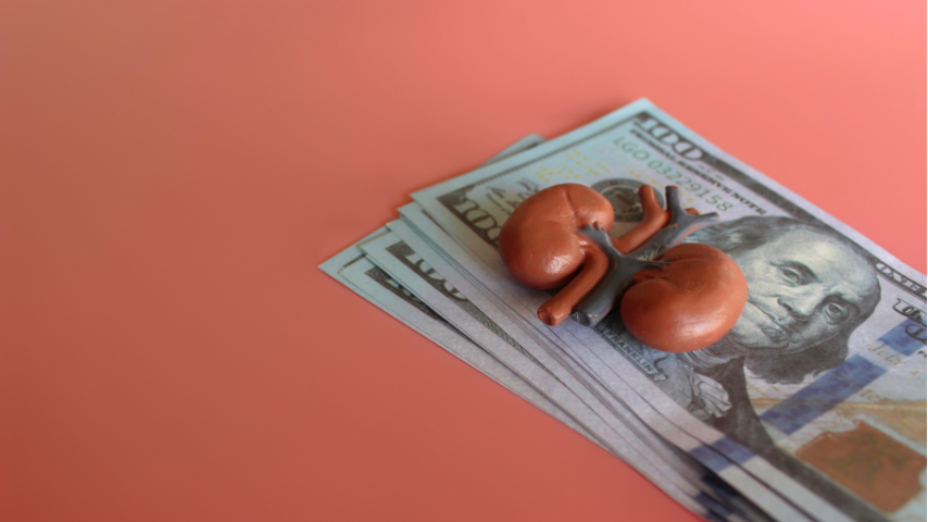 The Real Cost of a Kidney Transplant in India-Surgery, Medicines & Long-Term Care Explained