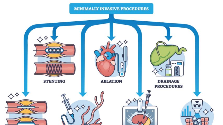What_Exactly_Is_Interventional_Radiology