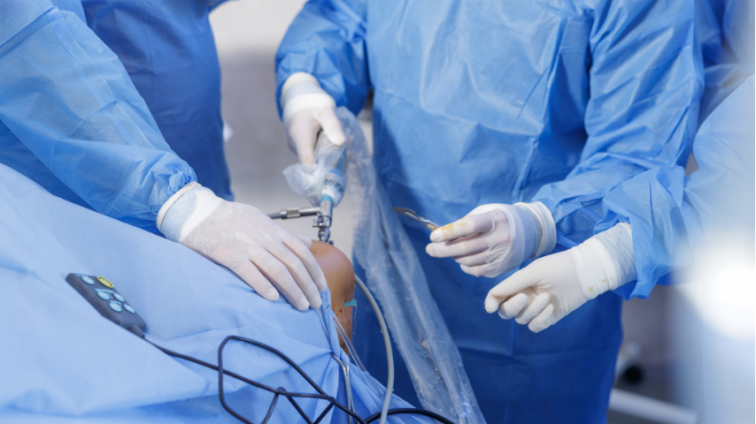 How Do You Choose the Right Surgeon and Graft Type for ACL Reconstruction (for Your Lifestyle)