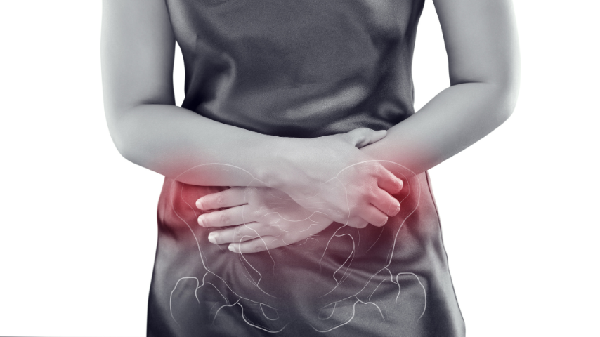 Why Some Women Choose Embolisation for Pelvic Congestion Syndrome Instead of Surgery