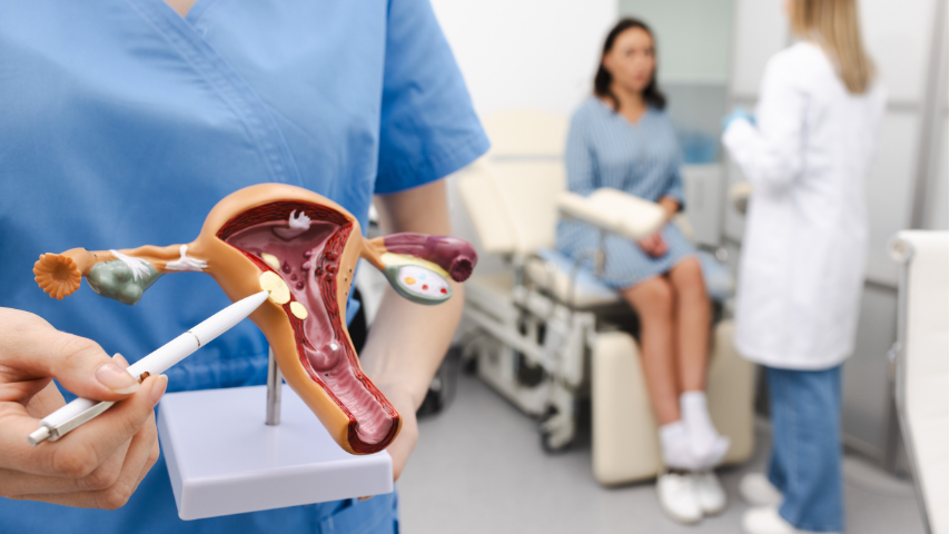 Can Embolisation Treat My Uterine Fibroids Without a Hysterectomy