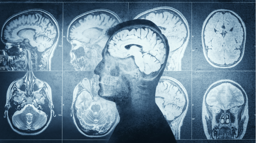 Post-Op Protocols That Drive Better Outcomes After Endoscopic Brain Surgery