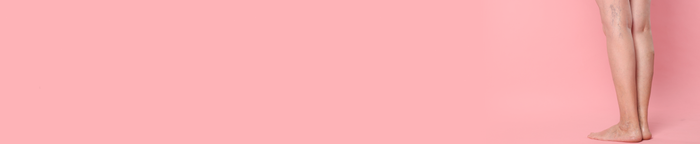 Leading Vascular and Endovascular Surgery Hospital In Chennai