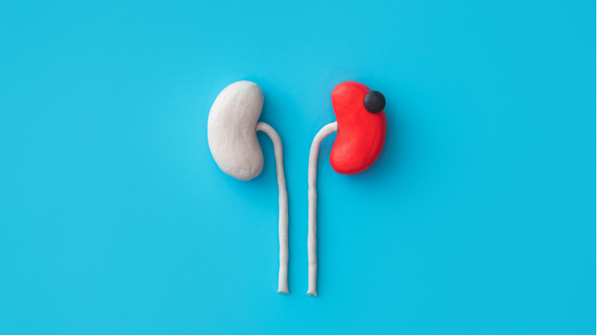 Everything You Need to Know Before a Kidney Tumour Biopsy
