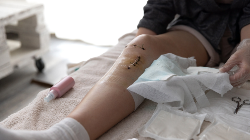 ACL Reconstruction in India