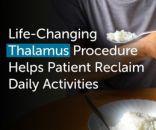 Thalamotomy for Dystonic Tremors Ravindra Karjule's Remarkable Recovery Gleneagles Hospital, Mumbai1