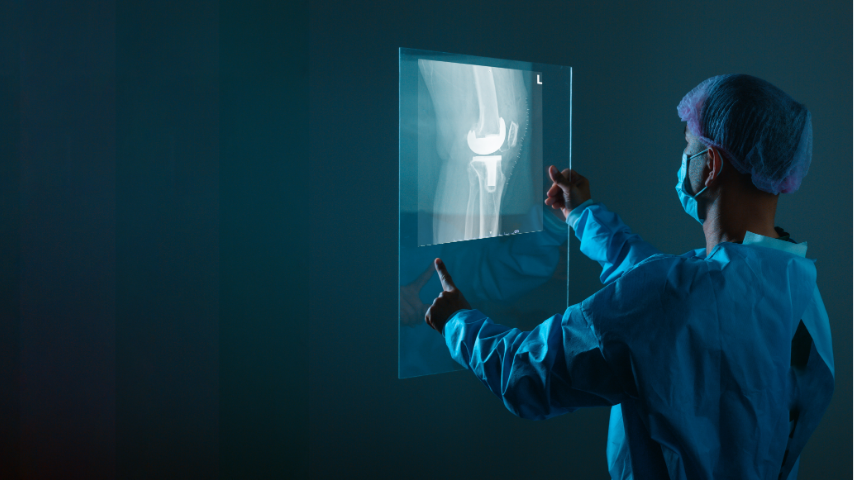 Non-Surgical Options After ACL Tear Is Surgery Always Necessary