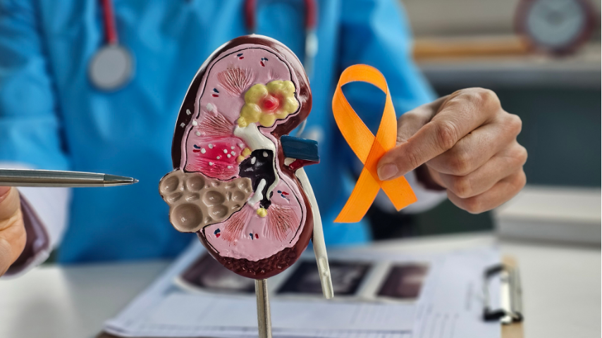 Risks, Complications and How to Reduce Them After RIRS