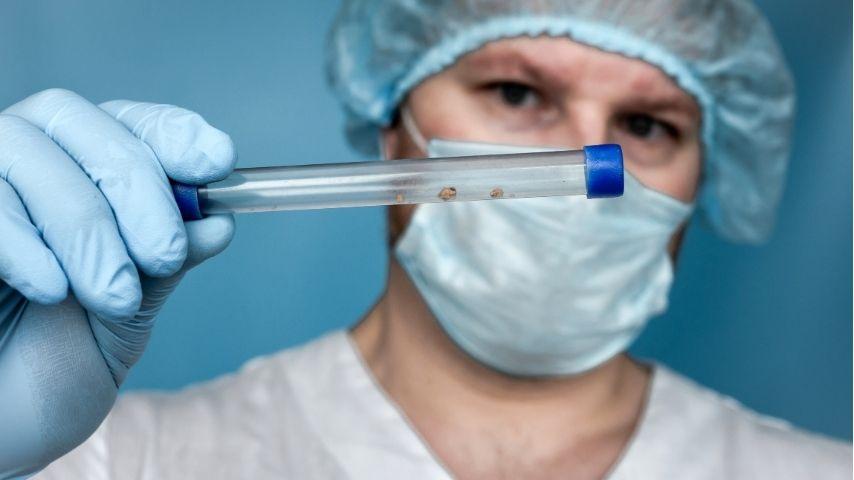 Success Rates & Risks of Kidney Stone Removal – What the Latest Studies Say