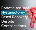Minimally Invasive Solution Robotic Surgery for Uterine Cyst at Gleneagles Hospital, Chennai1