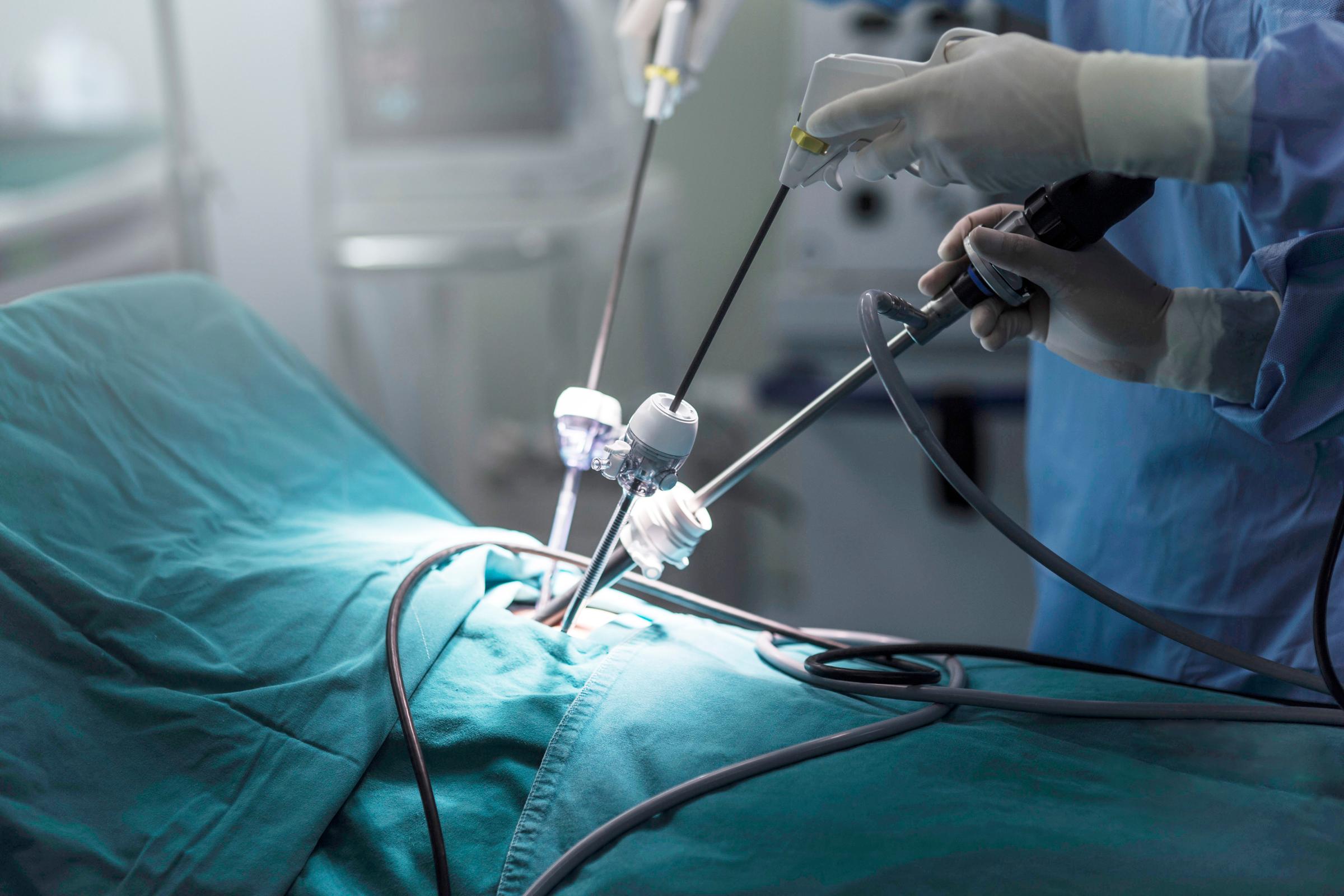 Laparoscopic Mini Gastric