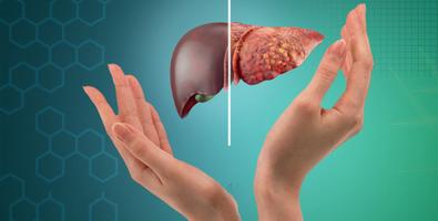 Reasons-for-Fatty-Liver-Disease-1