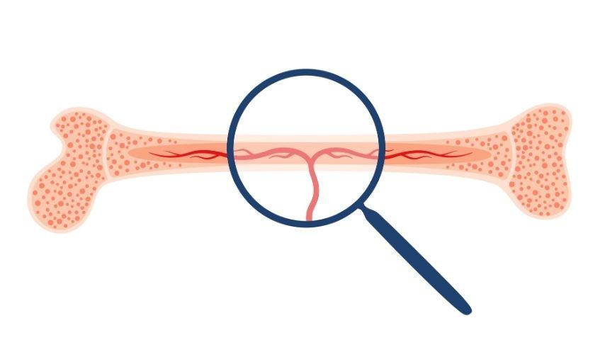 How Pediatric Bone Marrow Transplant Works- From Donor Search to Immune System Reset