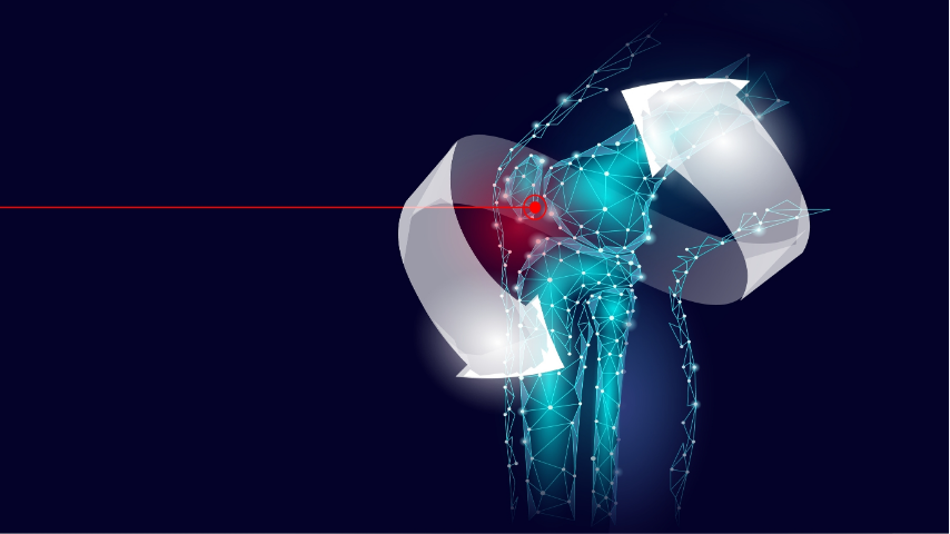 What to Expect the First 2 Weeks After ACL Graft Surgery Pain, Swelling, Home Care Tips