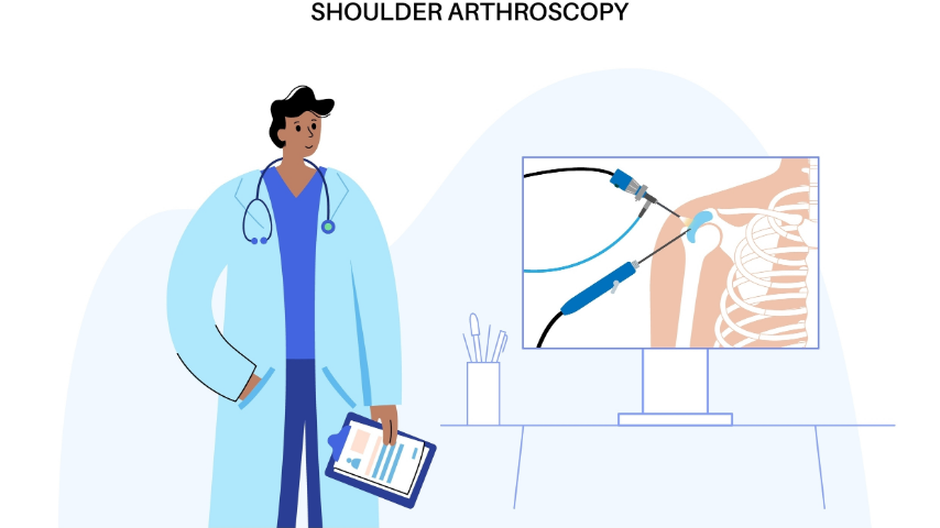 Why Am I Getting Shoulder Pain- Could Arthroscopy Be the Answer