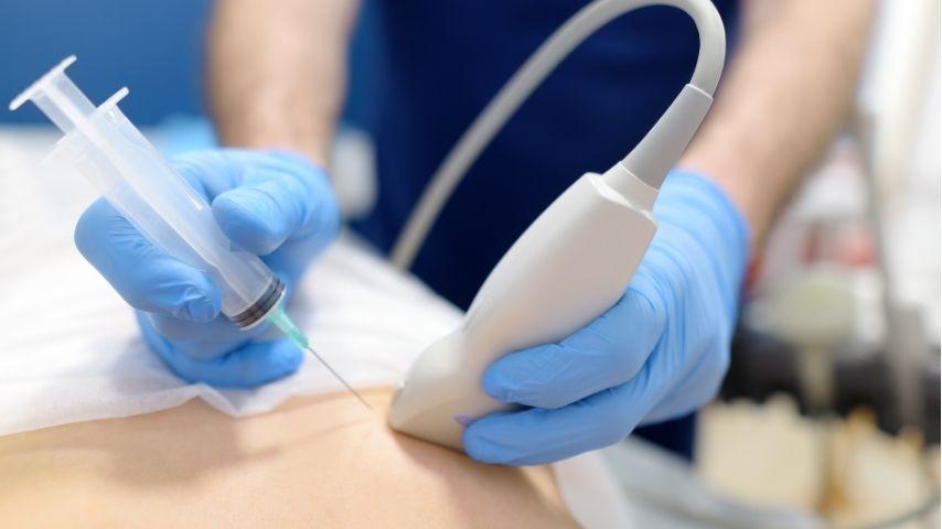 What Happens During an Ultrasound-Guided Breast Biopsy or Ablation- A Detailed Step-by-Step Guide for Patients