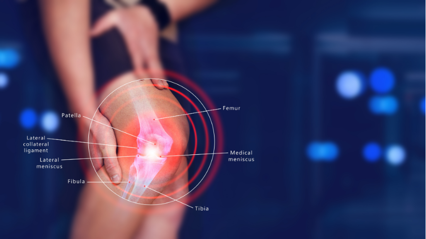What Happens to Your Knee When the ACL Tears_ Understanding the Injury Before Surgery