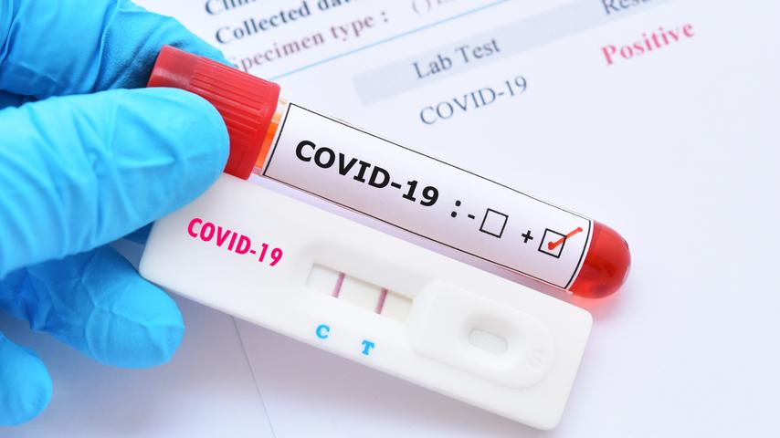 COVID-19 Tested Negative Or False-Negative?