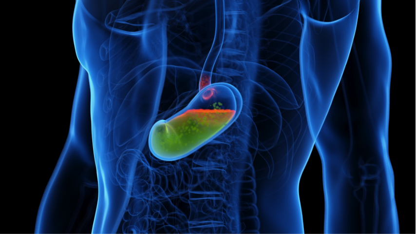 Understanding Hepatobiliary Interventions- When Your Liver or Bile Duct Needs a Little Help