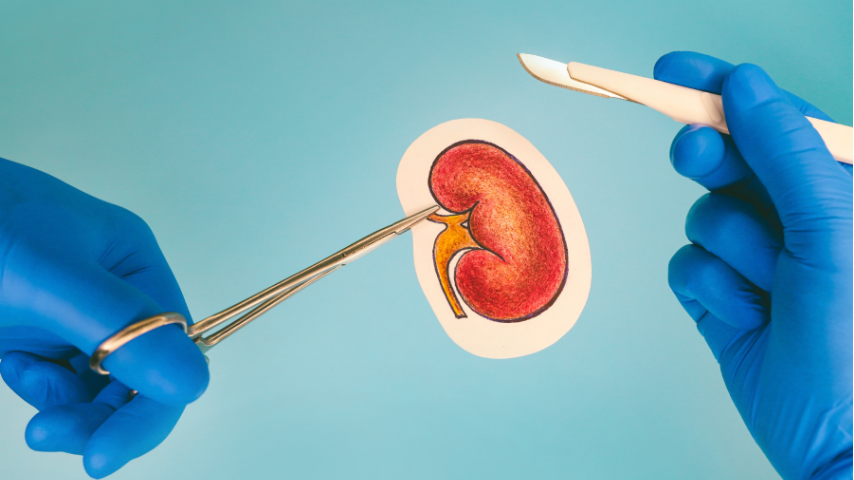 Managing Immunosuppressant Side Effects in Kidney Transplant