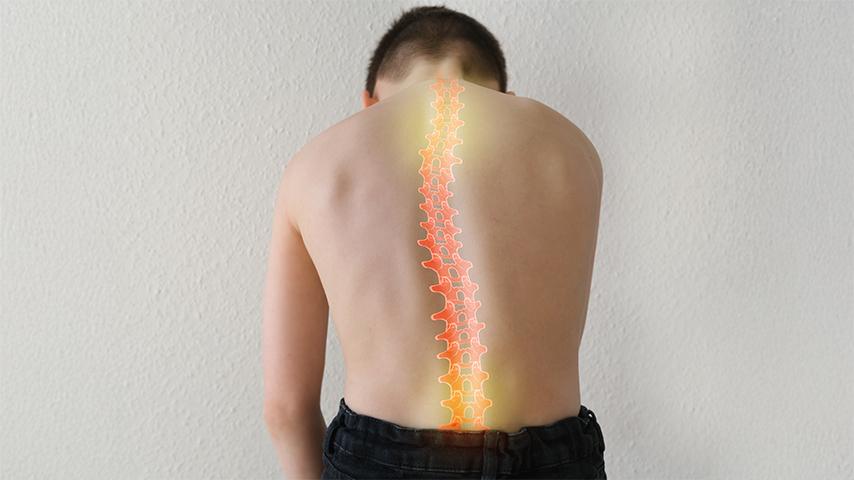 How-Chronic-Back-Pain-&-Deformity-Progress-Before-Spine-Reconstruction-Becomes-Inevitable