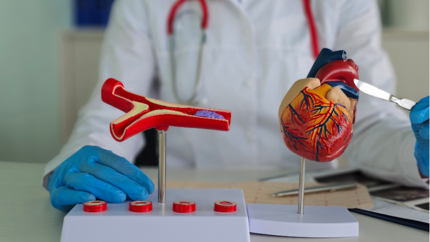 Double vs. Triple vs. Quintuple Bypass — How Many Grafts Can Your Heart Really Need