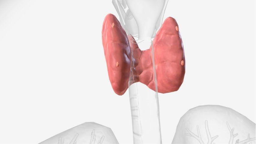 Ablation for Painful or Large Nodules- When Size, Symptoms or Cosmetic Concerns Push the Decision