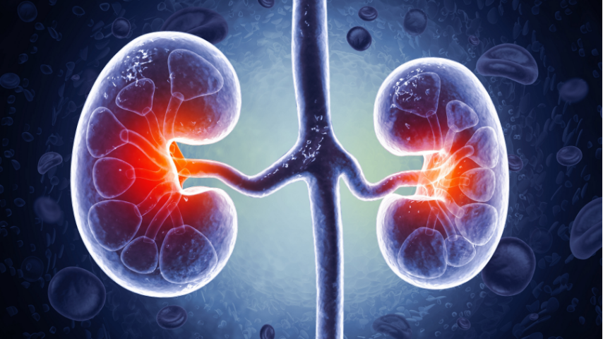 Signs Your Kidneys Are Failing-When to Consider a Transplant vs Managing with Care