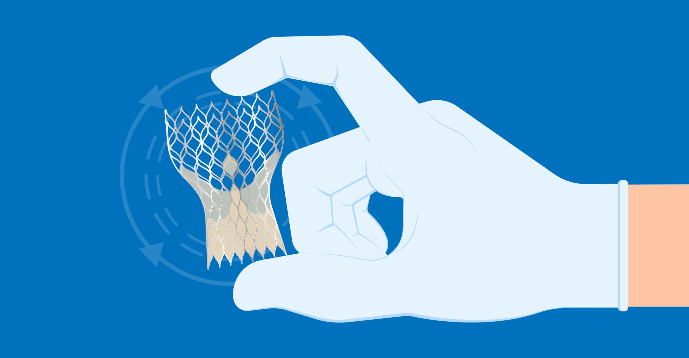 What to Expect from a Minimally Invasive Mitral Valve Repair 2