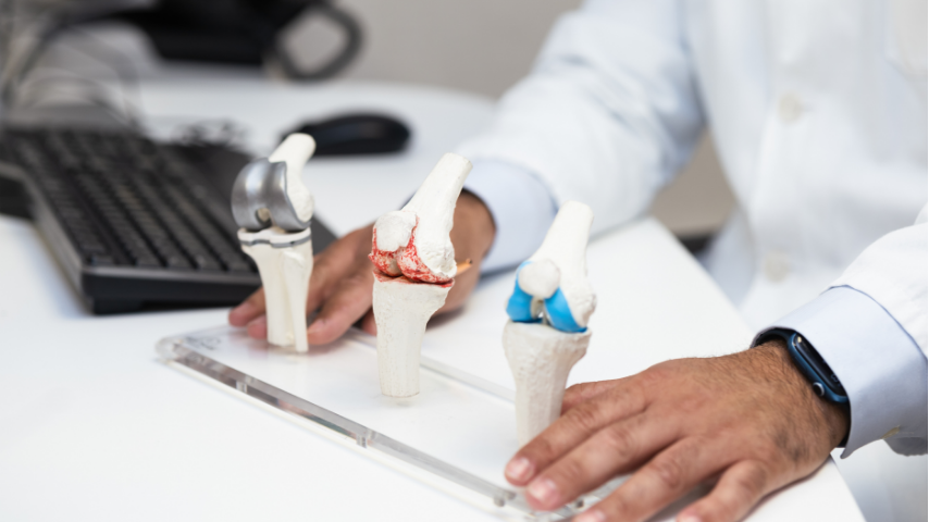 Total Knee Replacement What Implant Materials Should You Insist On