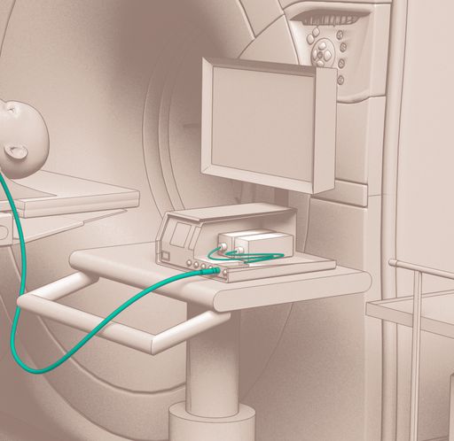 MW generator- solution