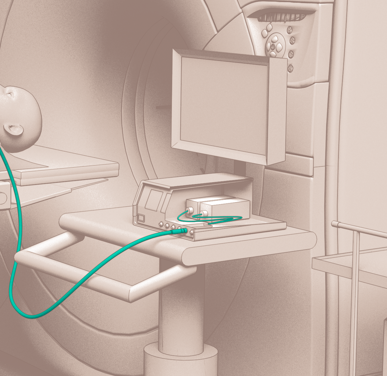 MW generator- solution