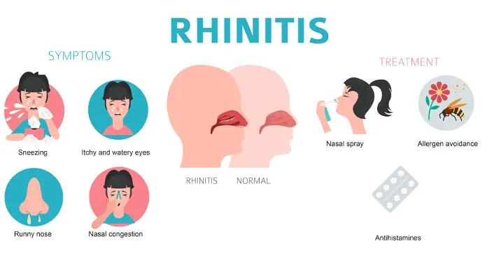 Nasal congestion deals in tagalog