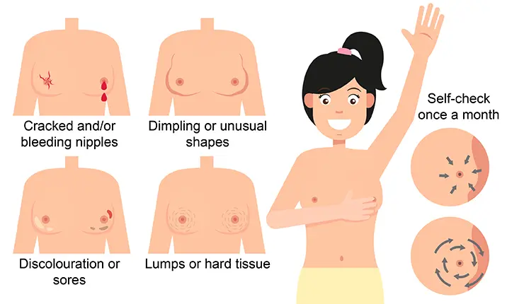 Breast Lumps – Know the basics  DG Laser & Cosmetic Gynecology Clinic