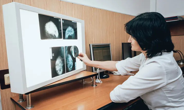 All you need to know about breast biopsies