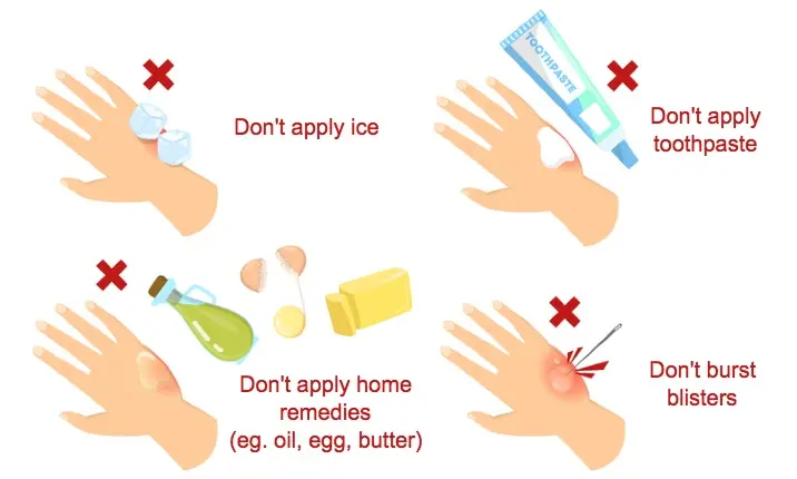 3. Management of Minor Burns