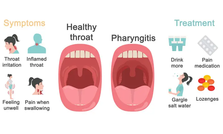 Viruses and the respiratory tract