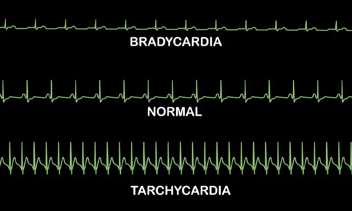 strong heart beats cause