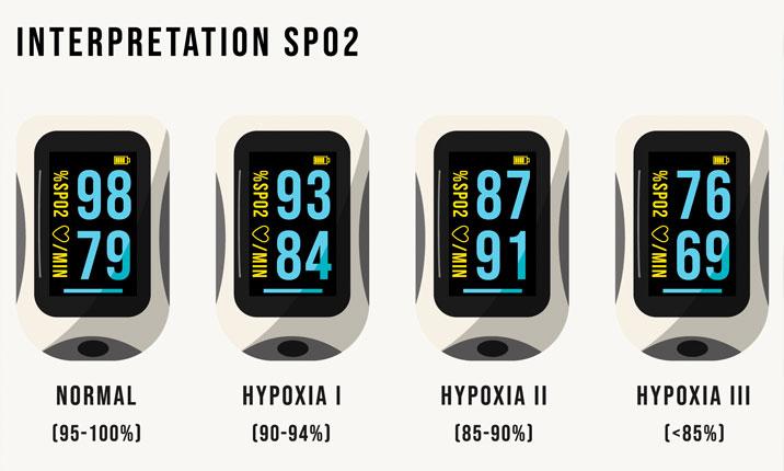 Oximeter Readings And Blood Oxygen Levels   EyJvYXV0aCI6eyJjbGllbnRfaWQiOiJmcm9udGlmeS1leHBsb3JlciJ9LCJwYXRoIjoiaWhoLWhlYWx0aGNhcmUtYmVyaGFkXC9hY2NvdW50c1wvYzNcLzQwMDA2MjRcL3Byb2plY3RzXC8yMDlcL2Fzc2V0c1wvNjNcLzM5MDEyXC80MjAwY2Y3ZDkyMGM0ODA5YTdiMDA0ZGUyMGI1MDUzZi0xNjU4MzAyNzA5LmpwZyJ9 Ihh Healthcare Berhad PvdldbPyX 2Z WvfGC98xqiIQpbG RHusTLmECNMpRU