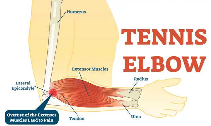 How Long Does a Sports Injury Take to Heal?