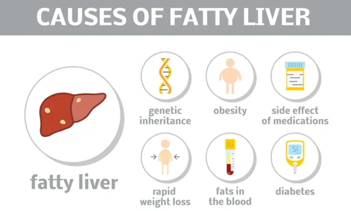 Myth only alcoholics get fatty liver