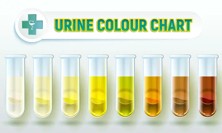 Urine colour indication