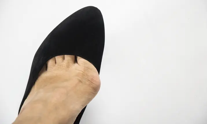 High heels and toe problems