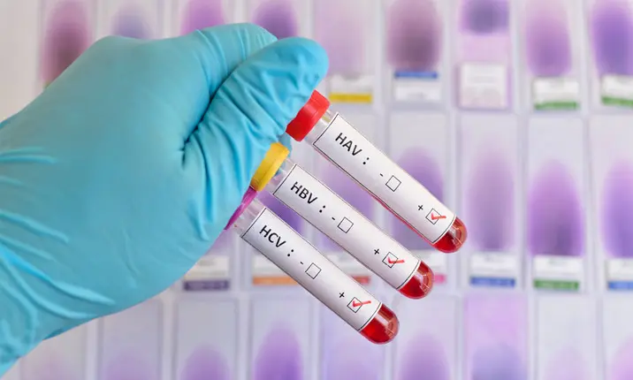 Hepatitis - Should I get tested?