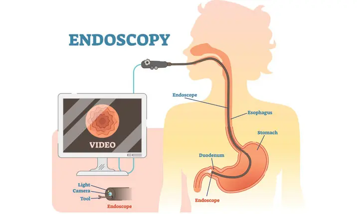 During endoscope endoscopy