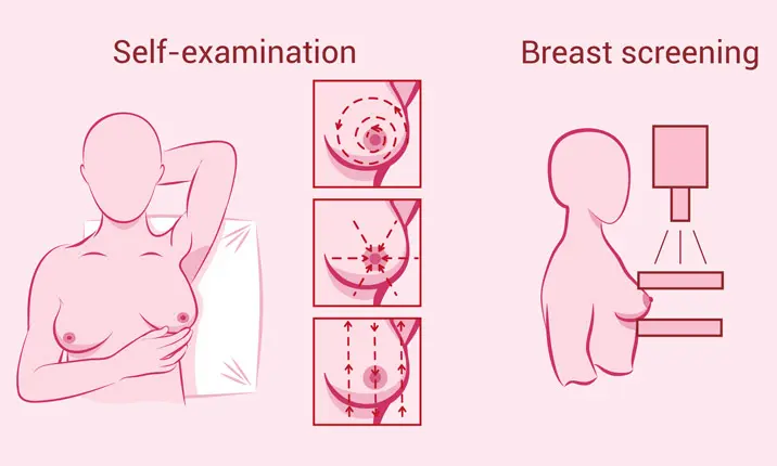 乳房检查